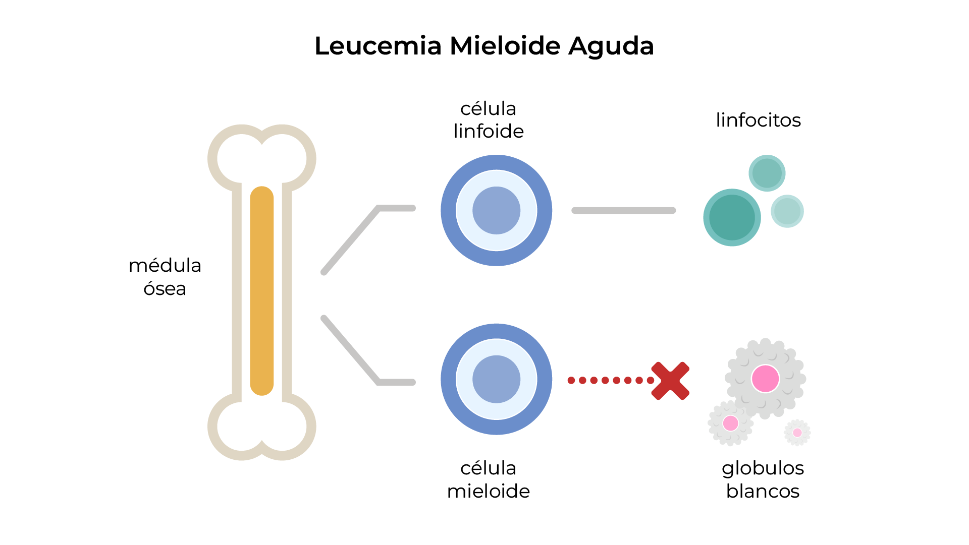 Comparación de conteo normal vs. anemia