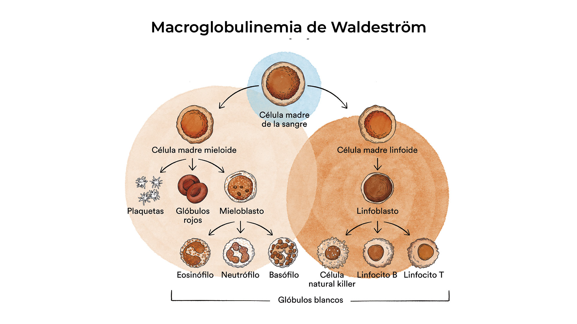 Comparación de conteo normal vs. anemia