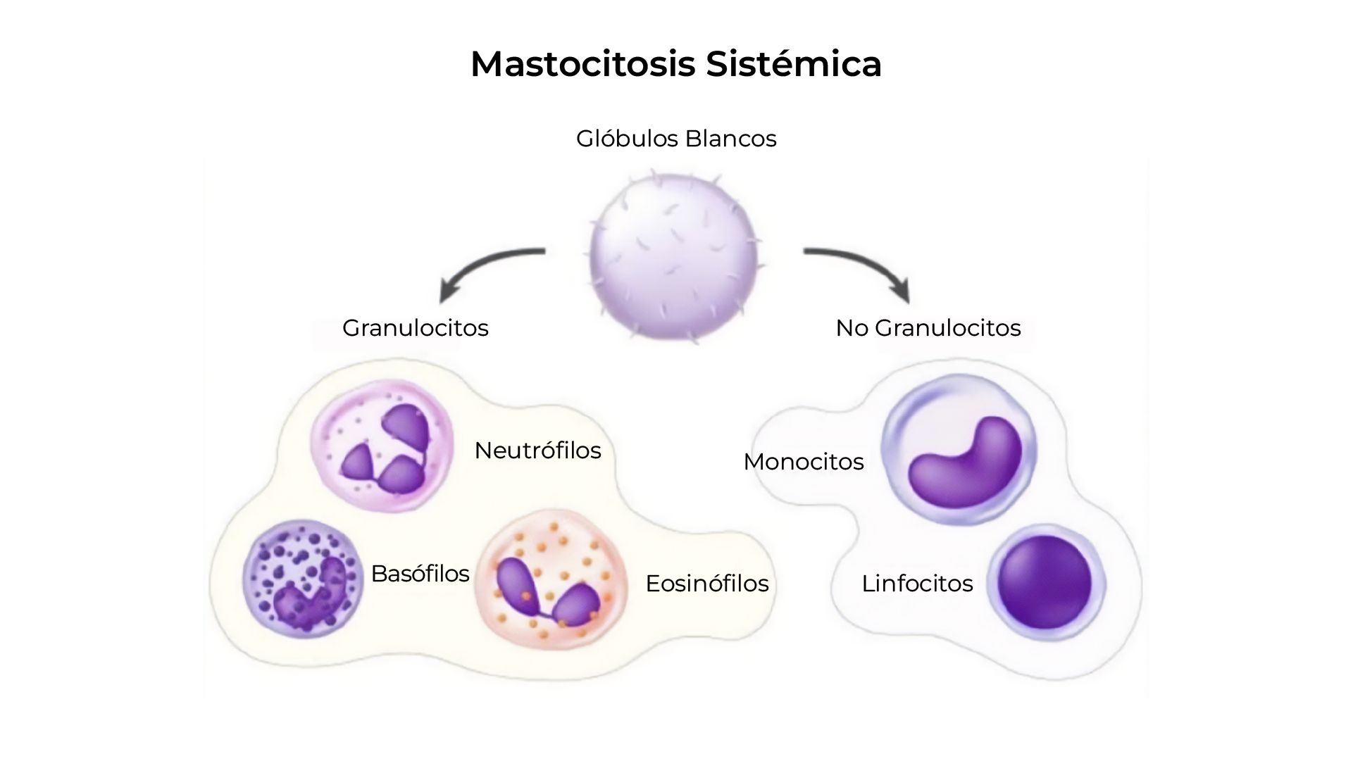 Comparación de conteo normal vs. anemia
