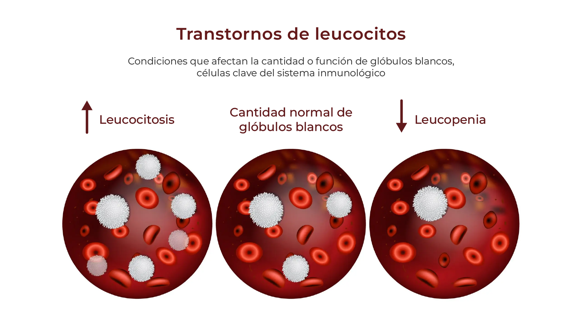 Trastornos de leucocitos