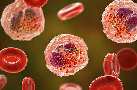 Síndrome hipereosinofílico